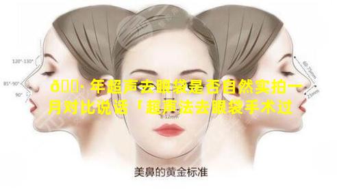 🕷 年超声去眼袋是否自然实拍一月对比说话「超声法去眼袋手术过程和一个月前后对比」